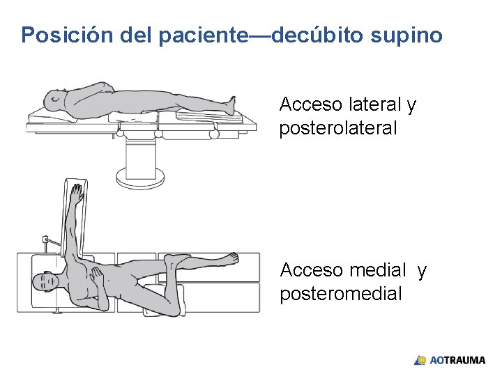 Posición del paciente—decúbito supino Acceso lateral y posterolateral Acceso medial y posteromedial 