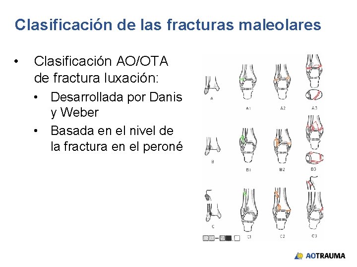 Clasificación de las fracturas maleolares • Clasificación AO/OTA de fractura luxación: • Desarrollada por