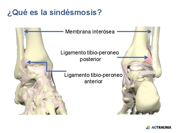 ¿Qué es la sindésmosis? Membrana interósea Ligamento tibio-peroneo posterior Ligamento tibio-peroneo anterior 