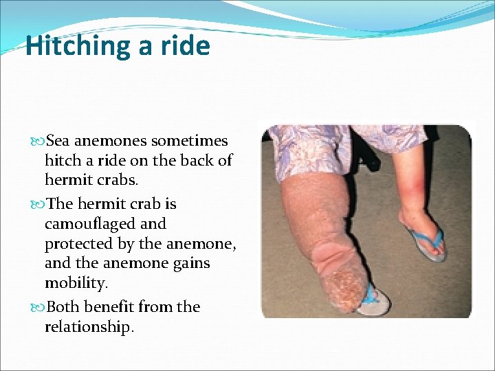 Hitching a ride Sea anemones sometimes hitch a ride on the back of hermit