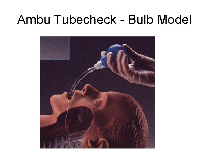 Ambu Tubecheck - Bulb Model 