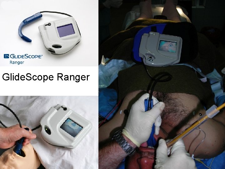 Glide. Scope Ranger 