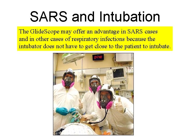 SARS and Intubation The Glide. Scope may offer an advantage in SARS cases and