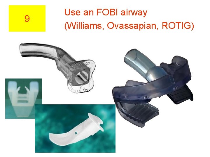 9 Use an FOBI airway (Williams, Ovassapian, ROTIG) 