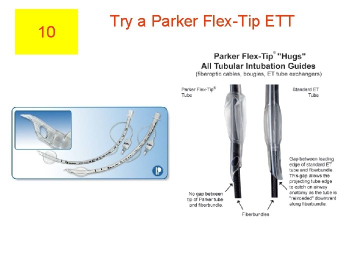 10 Try a Parker Flex-Tip ETT 