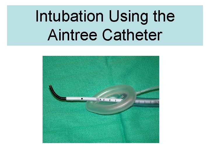 Intubation Using the Aintree Catheter 