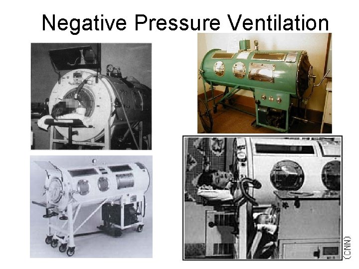Negative Pressure Ventilation 