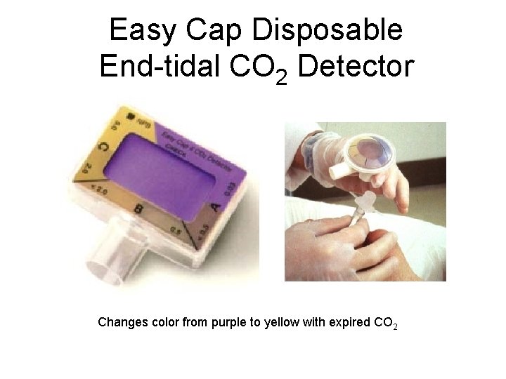 Easy Cap Disposable End-tidal CO 2 Detector Changes color from purple to yellow with