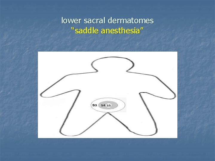 lower sacral dermatomes “saddle anesthesia” 