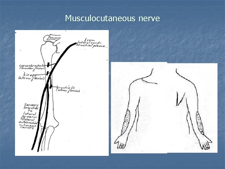 Musculocutaneous nerve 