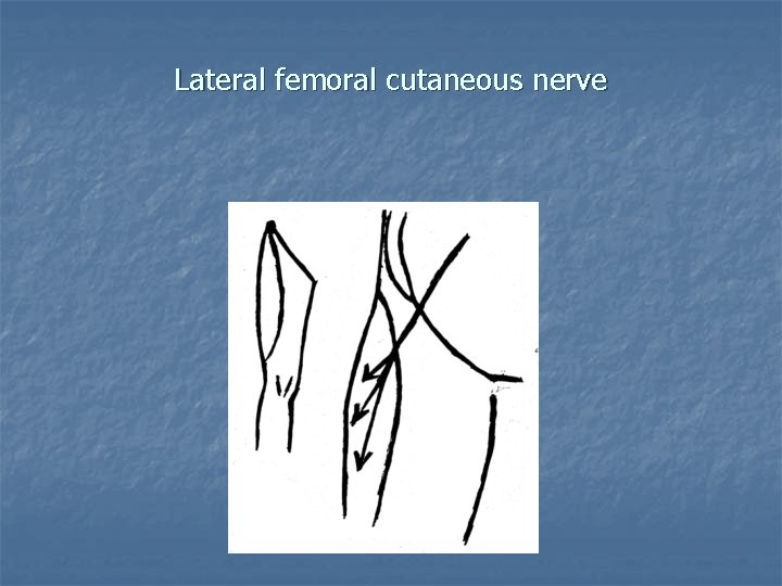 Lateral femoral cutaneous nerve 