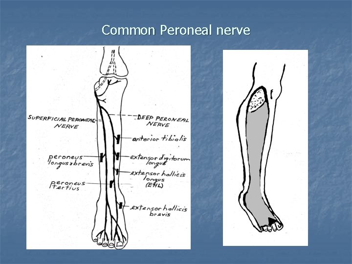 Common Peroneal nerve 