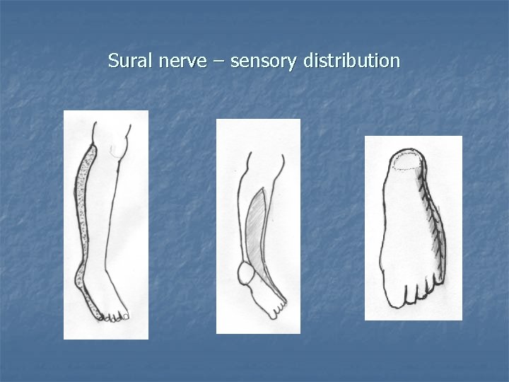 Sural nerve – sensory distribution 