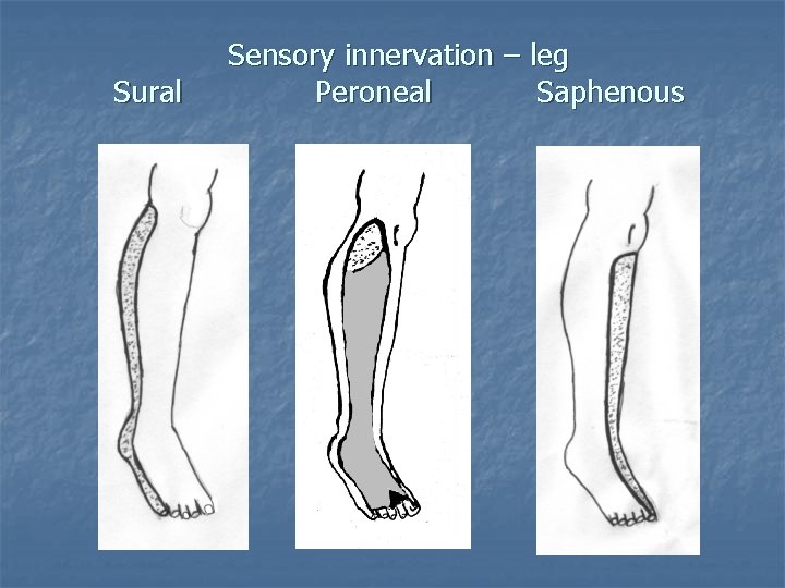 Sural Sensory innervation – leg Peroneal Saphenous 