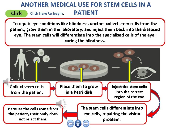 ANOTHER MEDICAL USE FOR STEM CELLS IN A PATIENT Click here to begin. To