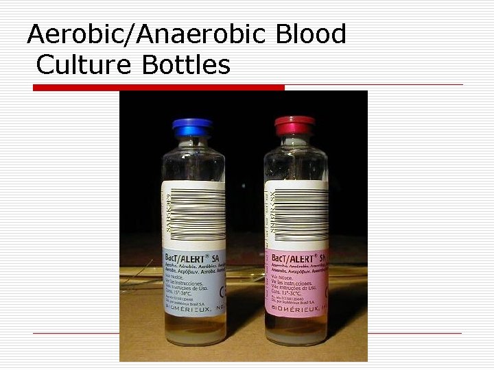 Aerobic/Anaerobic Blood Culture Bottles 