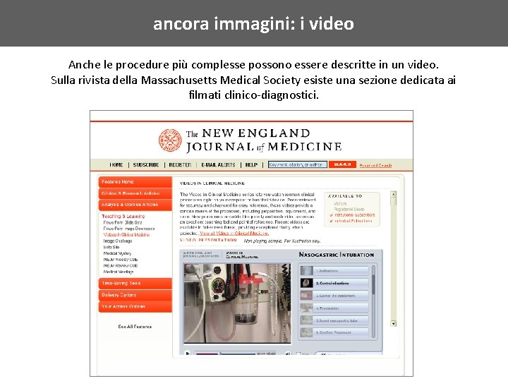 ancora immagini: i video Anche le procedure più complesse possono essere descritte in un