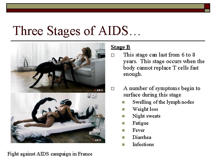 Three Stages of AIDS… Stage B o This stage can last from 6 to