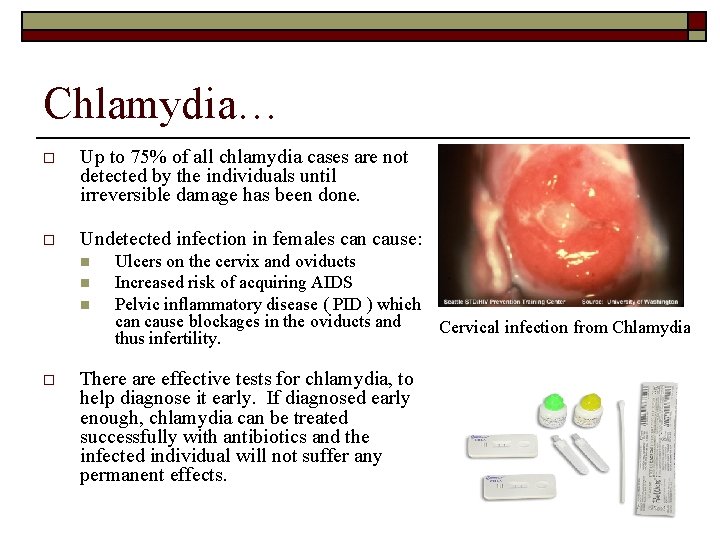 Chlamydia… o Up to 75% of all chlamydia cases are not detected by the