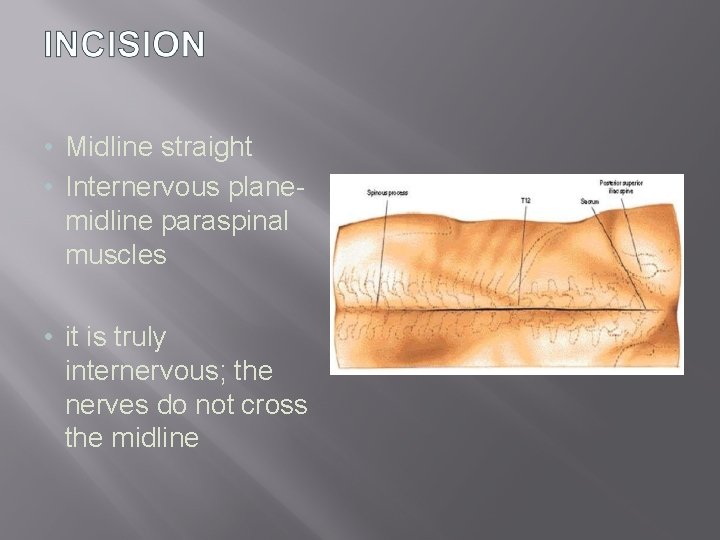  • Midline straight • Internervous planemidline paraspinal muscles • it is truly internervous;