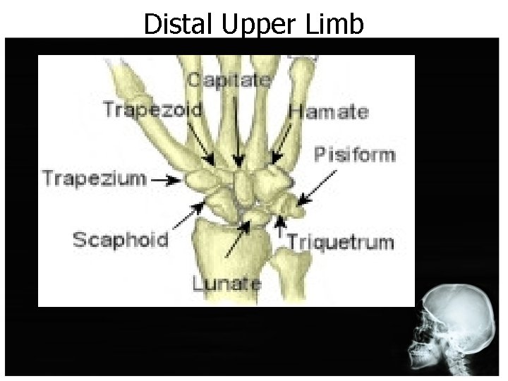 Distal Upper Limb 