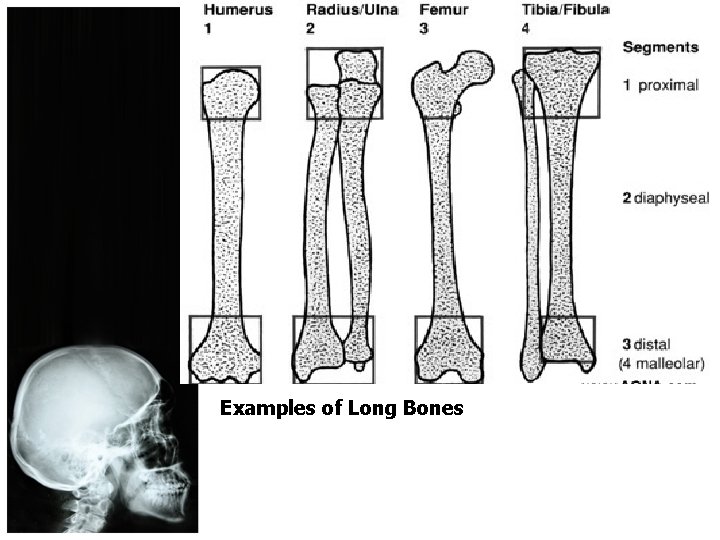 Examples of Long Bones 