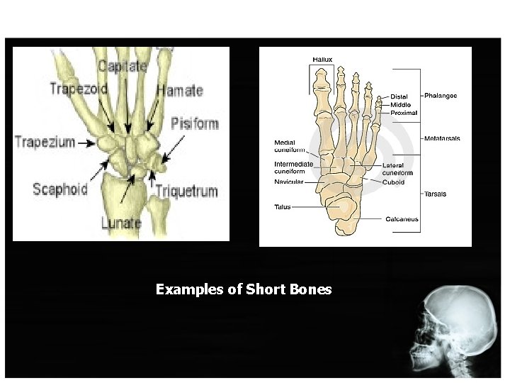 Examples of Short Bones 