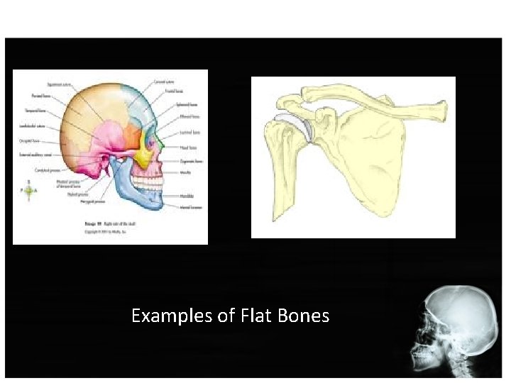 Examples of Flat Bones 