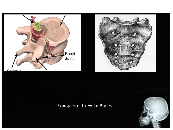 Examples of Irregular Bones 