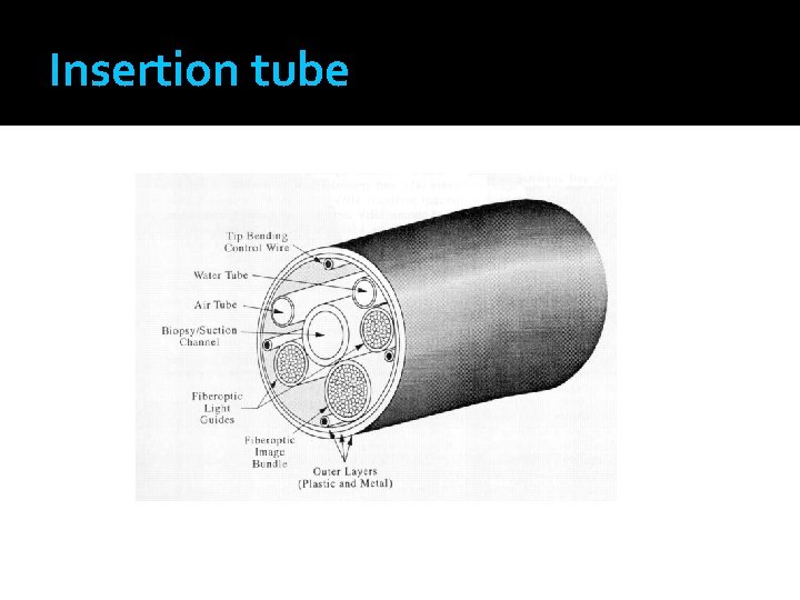 Insertion tube 