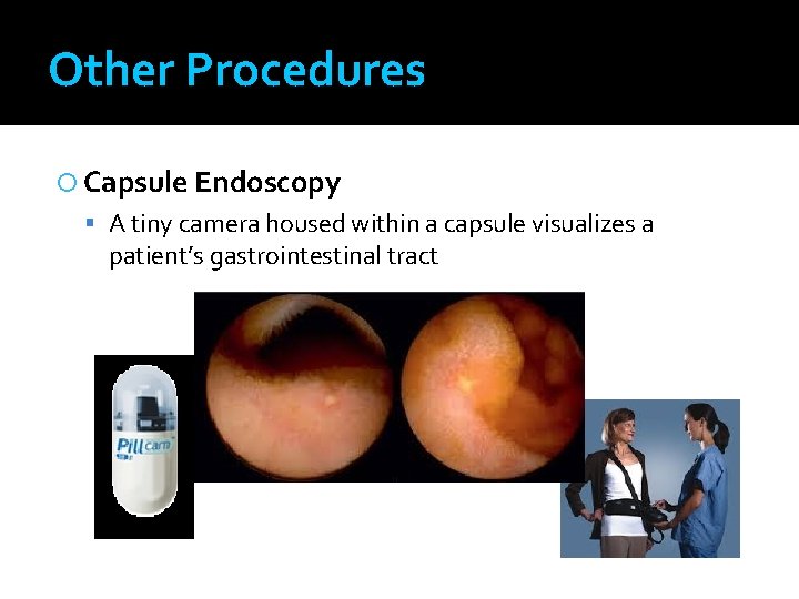 Other Procedures Capsule Endoscopy A tiny camera housed within a capsule visualizes a patient’s
