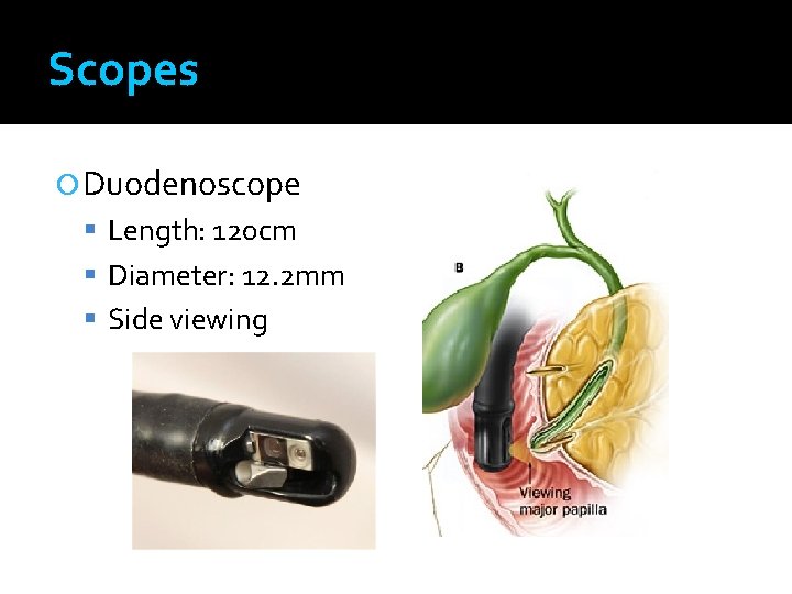 Scopes Duodenoscope Length: 120 cm Diameter: 12. 2 mm Side viewing 