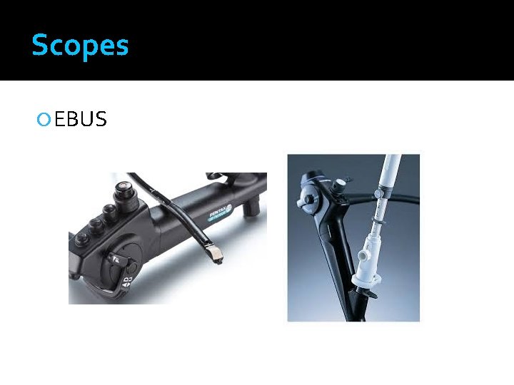 Scopes EBUS 