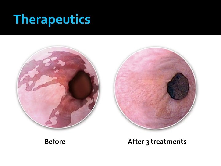Therapeutics Before After 3 treatments 