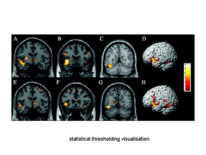 statistical thresholding visualisation 