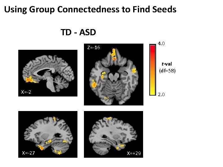 Using Group Connectedness to Find Seeds TD - ASD 4. 0 Z=-16 t-val (df=58)