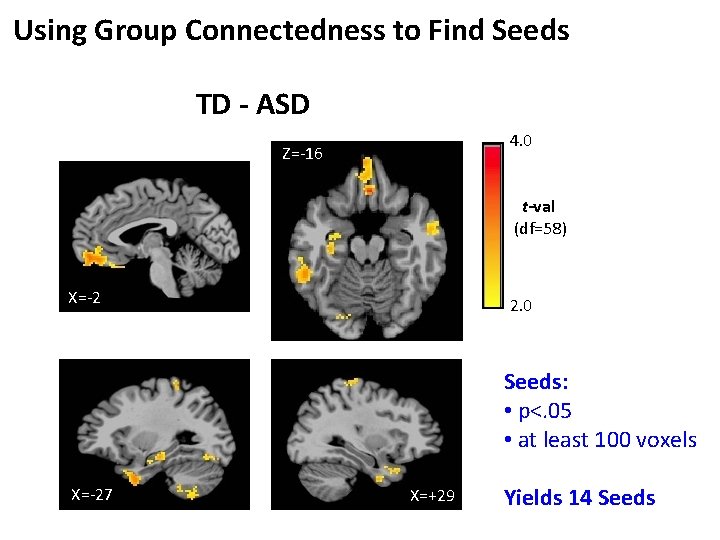 Using Group Connectedness to Find Seeds TD - ASD 4. 0 Z=-16 t-val (df=58)