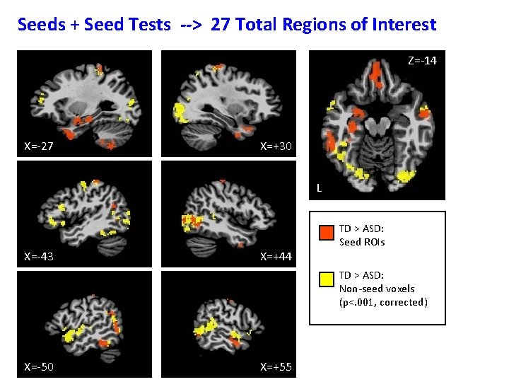 Seeds + Seed Tests --> 27 Total Regions of Interest Z=-14 X=-27 X=+30 L