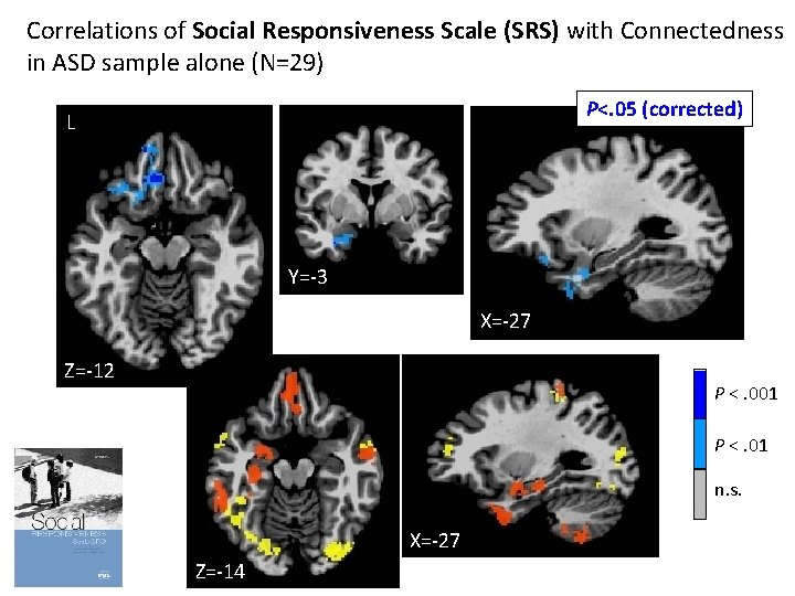 Correlations of Social Responsiveness Scale (SRS) with Connectedness in ASD sample alone (N=29) P<.