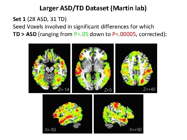 Larger ASD/TD Dataset (Martin lab) Set 1 (28 ASD, 31 TD) Seed Voxels involved