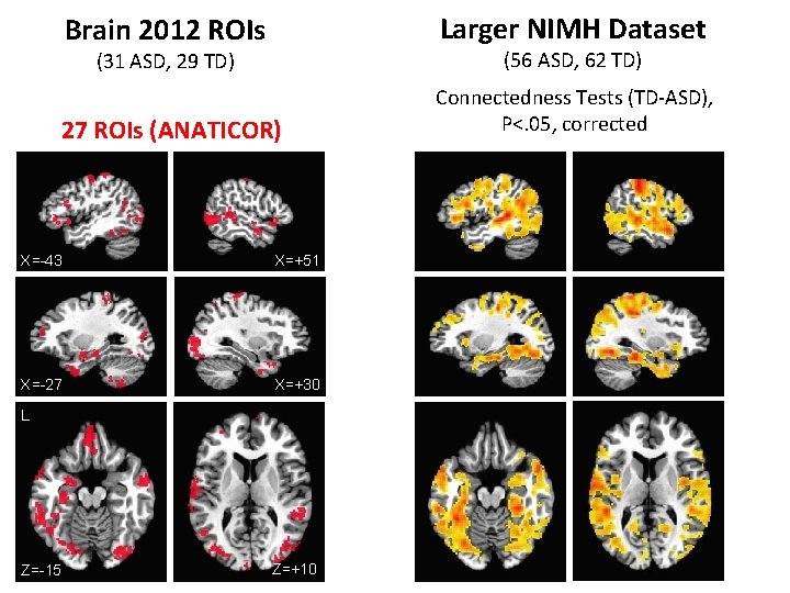 Brain 2012 ROIs Larger NIMH Dataset (31 ASD, 29 TD) (56 ASD, 62 TD)