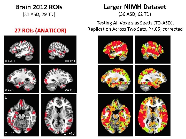 Brain 2012 ROIs Larger NIMH Dataset (31 ASD, 29 TD) (56 ASD, 62 TD)