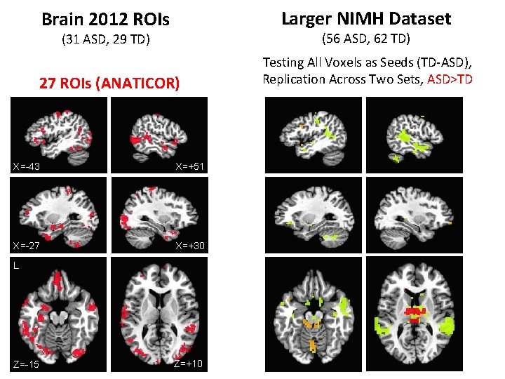 Brain 2012 ROIs Larger NIMH Dataset (31 ASD, 29 TD) (56 ASD, 62 TD)