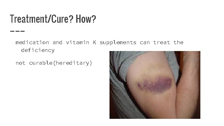 Treatment/Cure? How? medication and vitamin K supplements can treat the deficiency not curable(hereditary) 