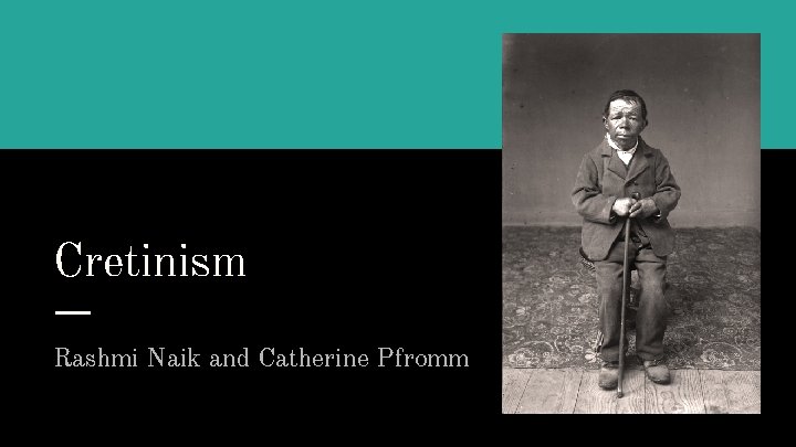 Cretinism Rashmi Naik and Catherine Pfromm 