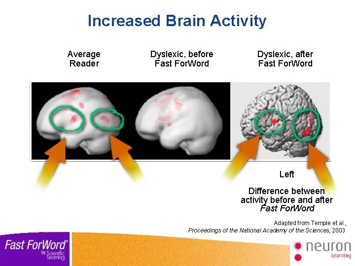 Increased Brain Activity Average Reader Dyslexic, before Fast For. Word Dyslexic, after Fast For.