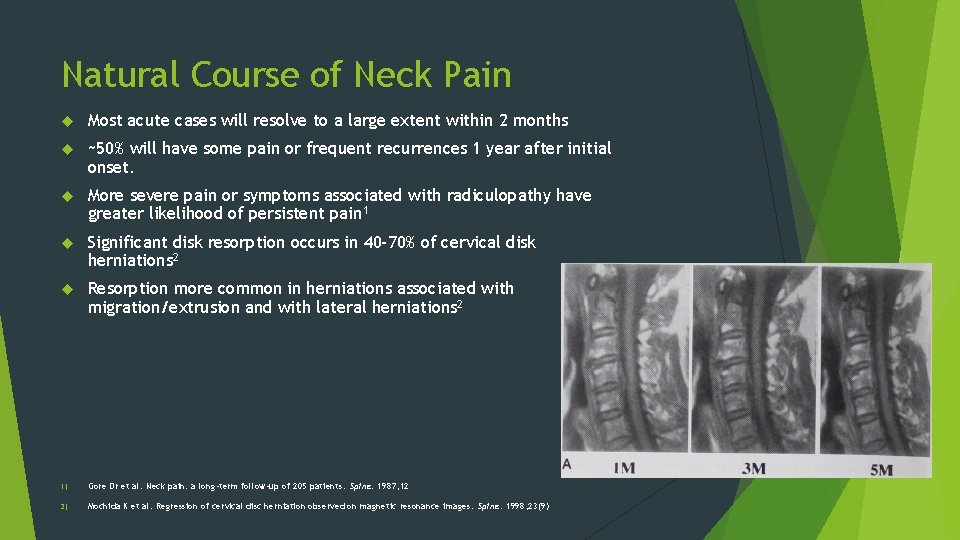 Natural Course of Neck Pain Most acute cases will resolve to a large extent