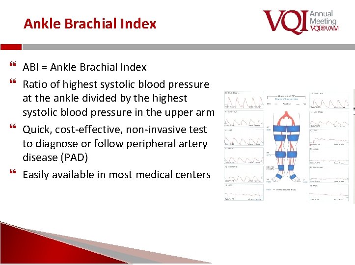 Ankle Brachial Index ABI = Ankle Brachial Index Ratio of highest systolic blood pressure