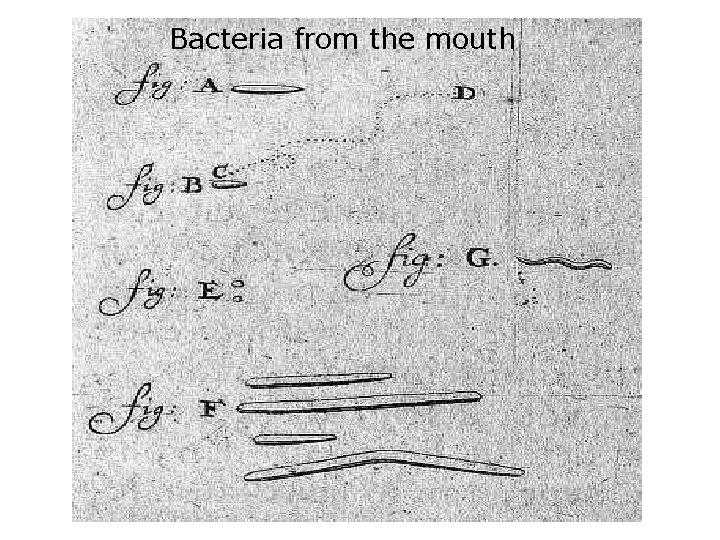 Bacteria from the mouth 