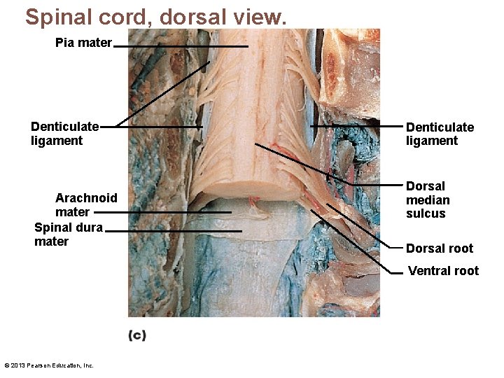 Spinal cord, dorsal view. Pia mater Denticulate ligament Arachnoid mater Spinal dura mater Denticulate